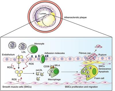 Getting to the Heart of the Matter: The Role of Regulatory T-Cells (Tregs) in Cardiovascular Disease (CVD) and Atherosclerosis